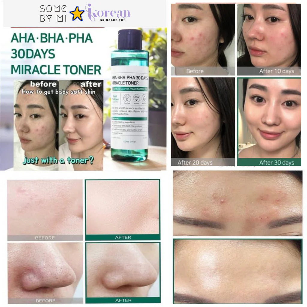 AHA AHA BHA PHA 30 Days Miracle Toner
